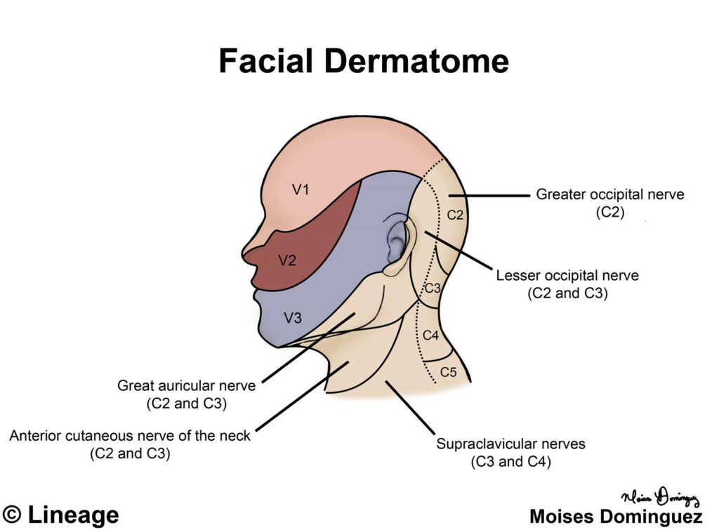 Dermatomes Neurology Medbullets Step Dermatome Map