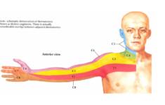 Anterior UE Dermatomes Quiz