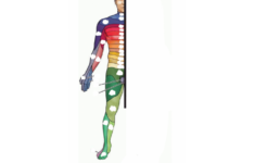 anterior view of the foerster dermatome map quiz Anterior View Of The Foerster Dermatome Map Quiz