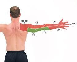 Cervical Dermatome Map Physical Therapy Massage Therapy Hand Therapy