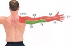 cervical dermatome map physical therapy massage therapy hand therapy Cervical Dermatome Map Physical Therapy Massage Therapy Hand Therapy