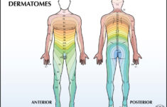 Dermatome Causes Symptoms Treatment Dermatome