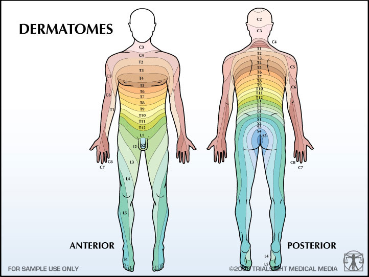 Dermatome Causes Symptoms Treatment Dermatome