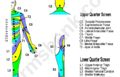 Dermatome Chart Printable Pdf Download