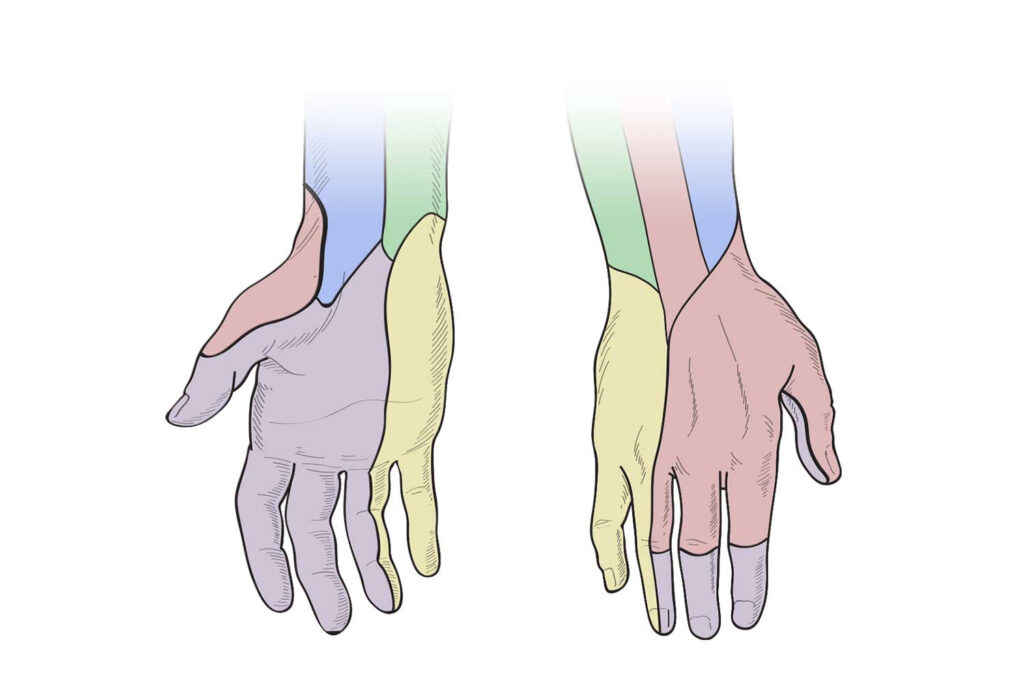 Dermatome Hands Trial Template LLC | Dermatome Map