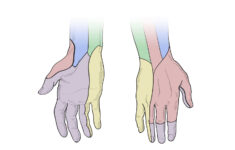 Dermatome hands Trial Template LLC