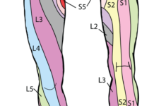 dermatome legs the skin and wellness center 2 Dermatome Legs The Skin And Wellness Center