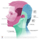 Dermatome Map Of Head By Annie Campbell Medical Tech Campbell