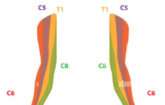 Dermatome Map Of The Upper Limb Stock Photo Alamy