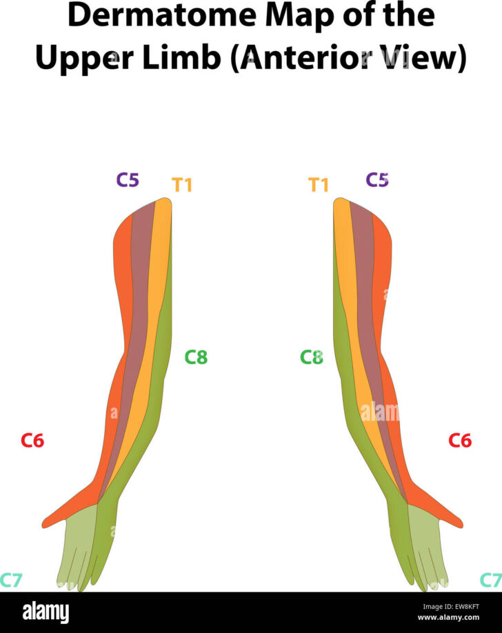 Upper Limb Dermatome Map