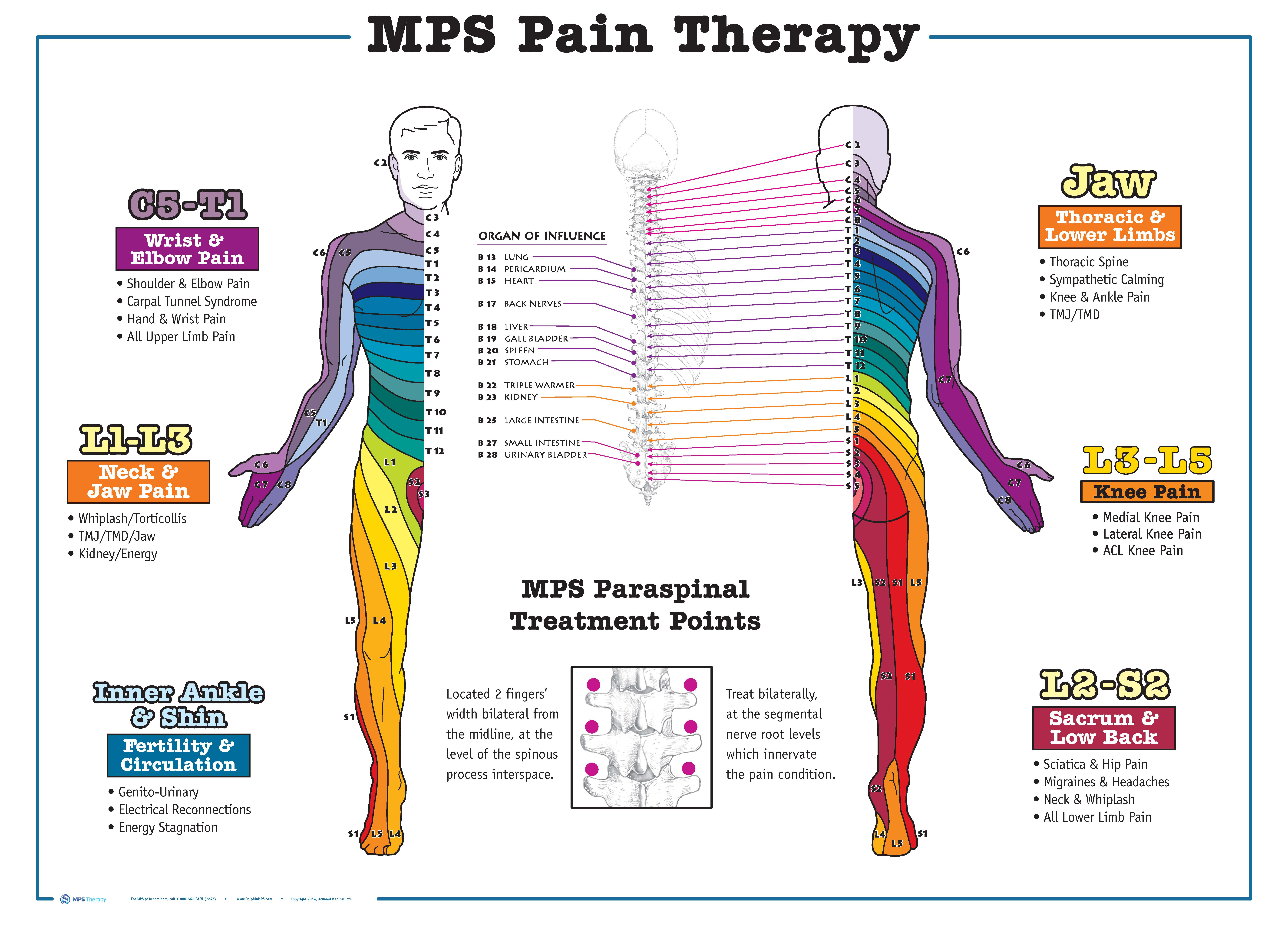 Dermatome Poster Large Dolphin Neurostim MPS Therapy