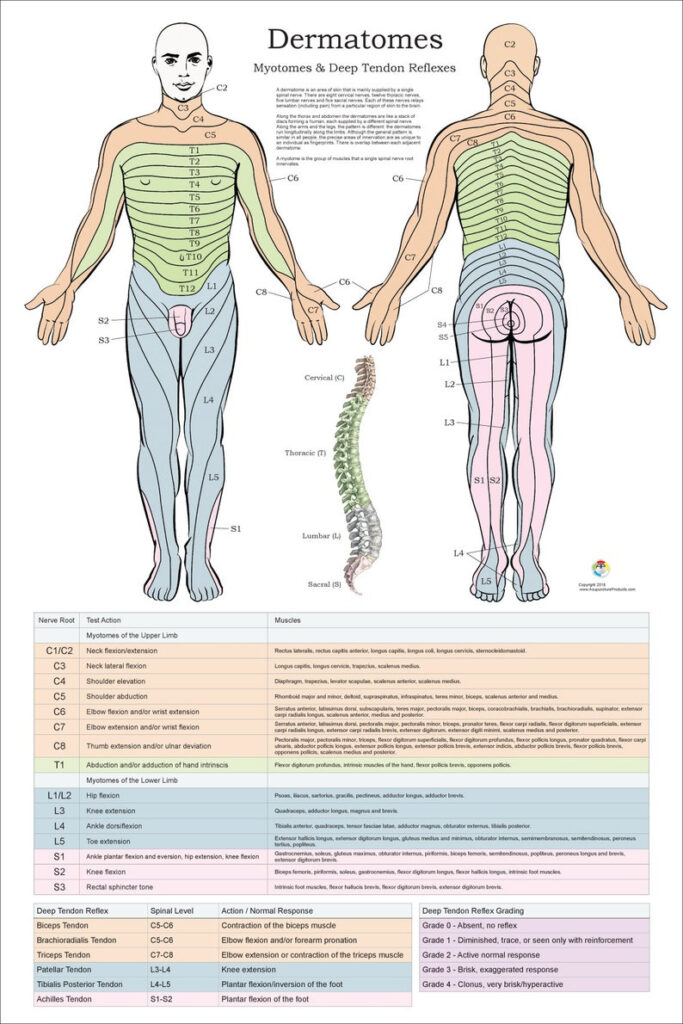 Dermatomes Myotomes And DTR Poster 24 X 36 Chiropractic Etsy 