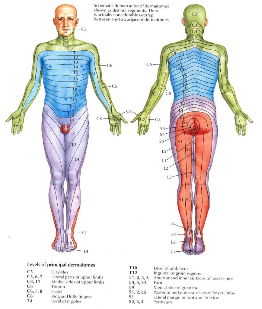 Dermatomes Nclex Radiculopathy Occupational Therapy Printable Map Of 