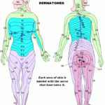 Dermatomes Ndash Mycerebellarstrokerecovery Medical Tech Historical