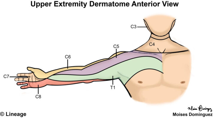 Upper Extremity Dermatome Map
