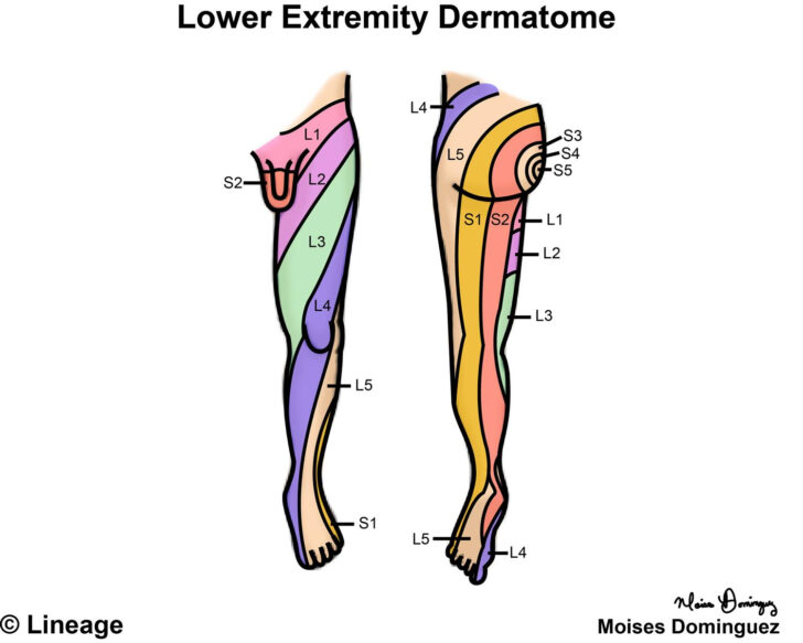Dermatome Map Lower Extremity