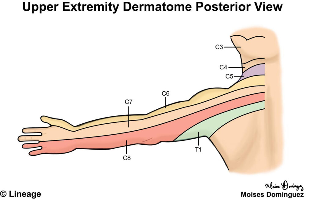 Dermatomes Neurology Medbullets Step 1 | Dermatome Map