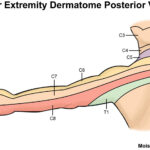 Dermatomes Neurology Medbullets Step 1