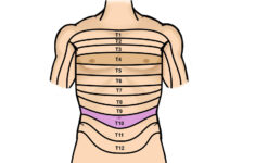 dermatomes neurology medbullets step 1 21 Dermatomes Neurology Medbullets Step 1