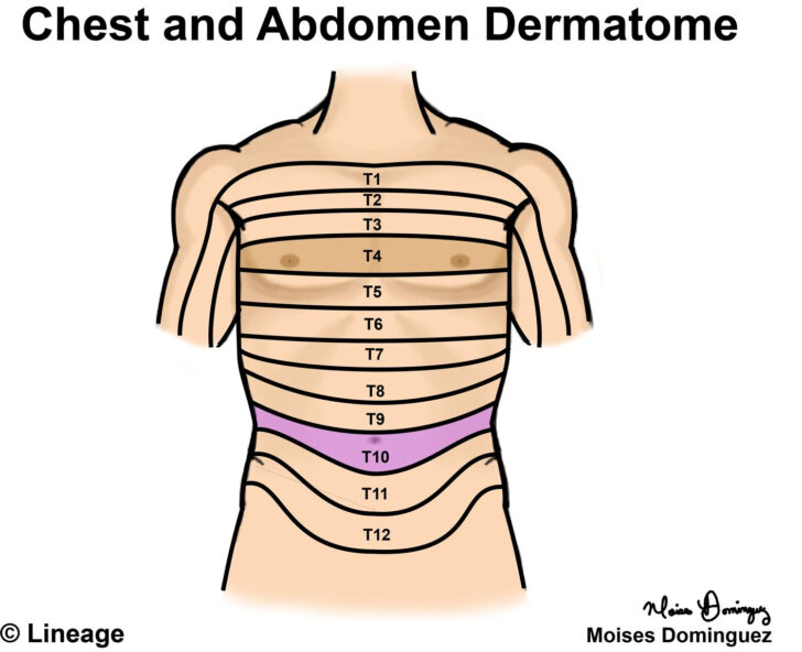 Dermatome Map Chest