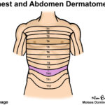 Dermatomes Neurology Medbullets Step 1