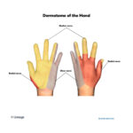 Dermatomes Neurology Medbullets Step 1