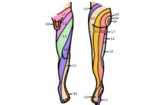 dermatomes neurology medbullets step 1 4 Dermatomes Neurology Medbullets Step 1