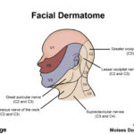 Dermatomes Neurology Medbullets Step 1