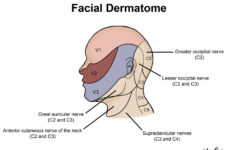 dermatomes neurology medbullets step 1 5 Dermatomes Neurology Medbullets Step 1