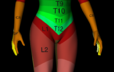 Dermatomes Of The Body Yahoo Image Search Results Fashion Body