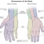 Dermatomes Of The Hand Anatomy Images Anatomy Musculocutaneous Nerve