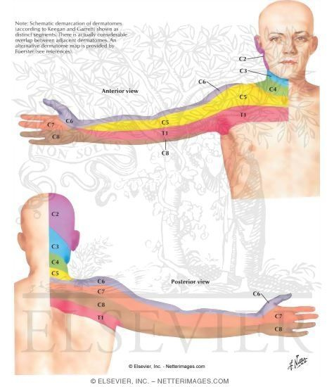 Dermatomes Of Upper Limb Patient Education Physical Therapy 