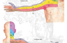 dermatomes of upper limb patient education physical therapy Dermatomes Of Upper Limb Patient Education Physical Therapy