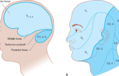 Headache Facial Pain Neupsy Key
