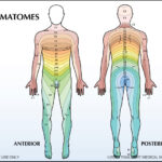 Herpes Zoster Ophthalmicus Dermatome Chart Herpes Free Me