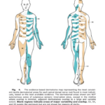 How Bad Are The Dermatomes By Tom Jesson Tom S Sciatica Newsletter