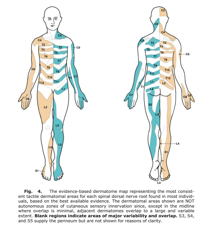 How Bad Are The Dermatomes By Tom Jesson Tom s Sciatica Newsletter