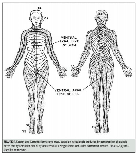 How Bad Are The Dermatomes By Tom Jesson Tom s Sciatica Newsletter