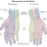 Metacarpal Fractures Core EM