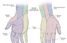metacarpal fractures core em 1 Metacarpal Fractures Core EM