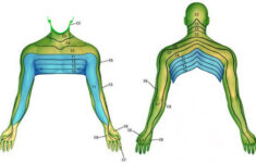 neck and arm pain spines dorset Neck And Arm Pain Spines Dorset