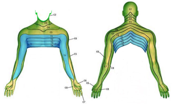 C7 Dermatome Map