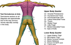 posterior dermatome map qxmd Posterior Dermatome Map QxMD
