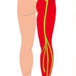 Sciatic Nerve Dermatome The Iveson Clinic For Physiotherapy And