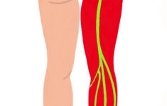 Sciatic Nerve Dermatome The Iveson Clinic For Physiotherapy And