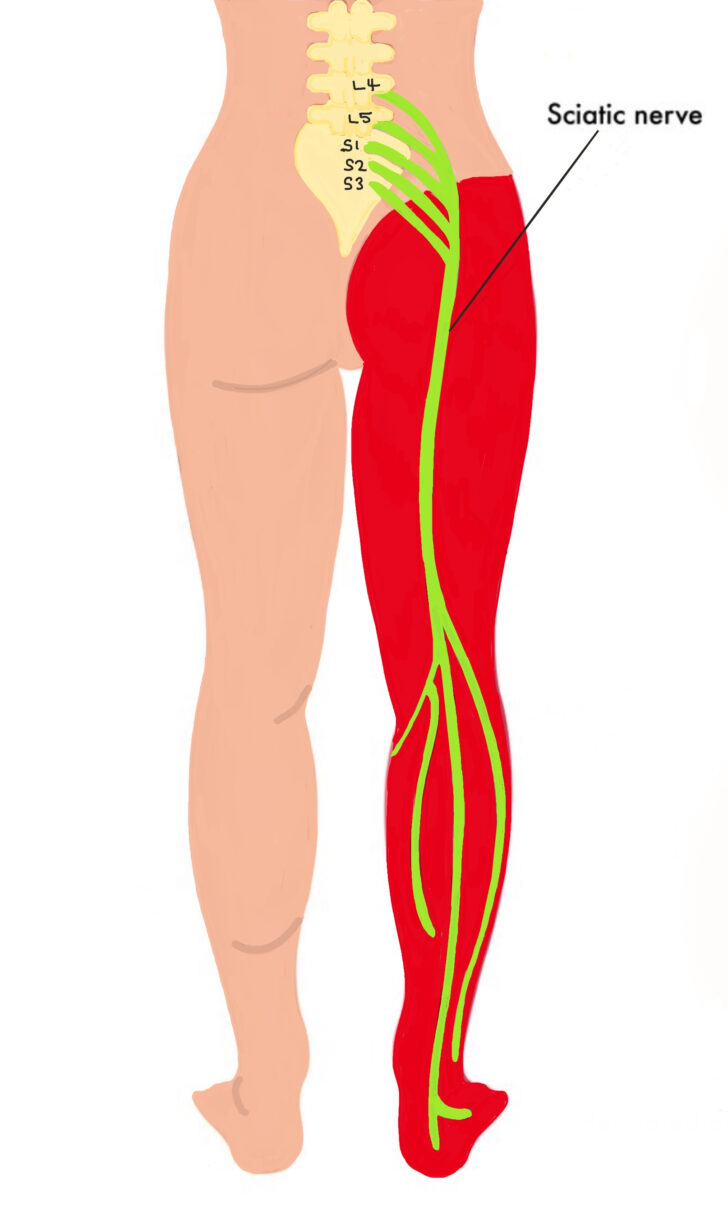 Sciatica Dermatome Map