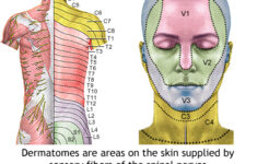 Shingles UF Health University Of Florida Health
