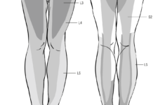 The History Of Dermatome Mapping Dermatology JAMA Neurology The