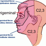 Trigeminal Nerve V