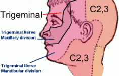 Trigeminal Nerve V